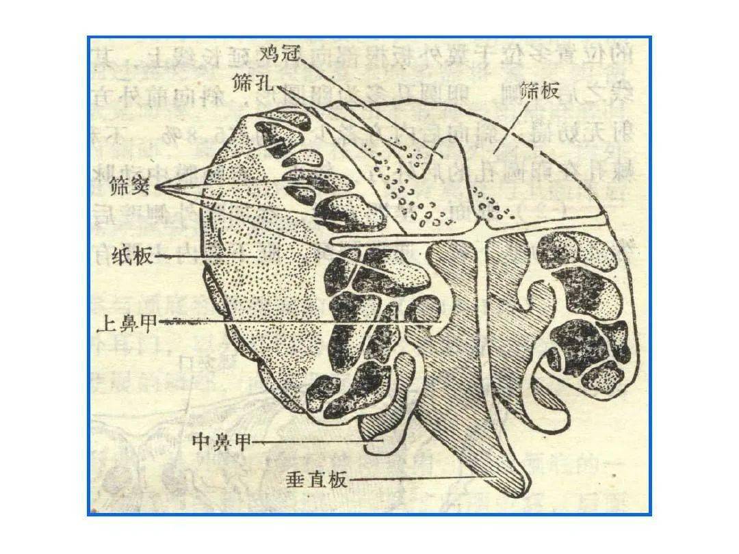 鼻的影像解剖