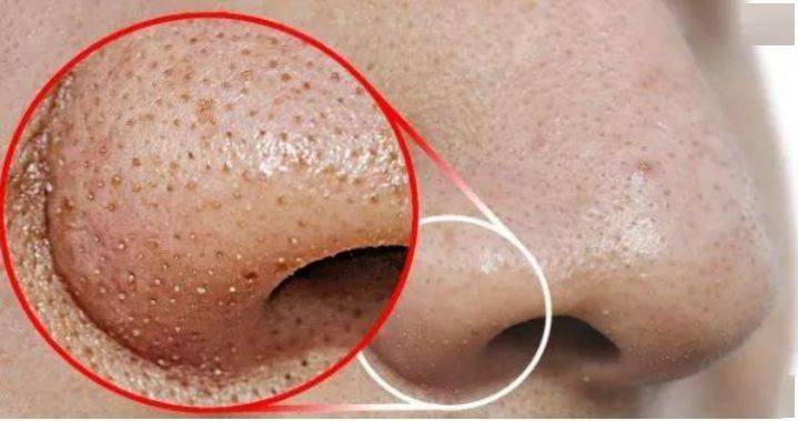 张天|张天爱比杨幂会“撩”?让小奶狗痴迷的她,到底有啥不一样?