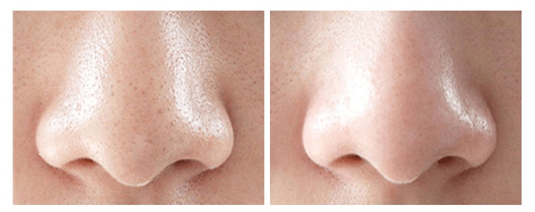 coco|有了ta,让你的白菜价护肤品用出贵妇级的惊人效果!