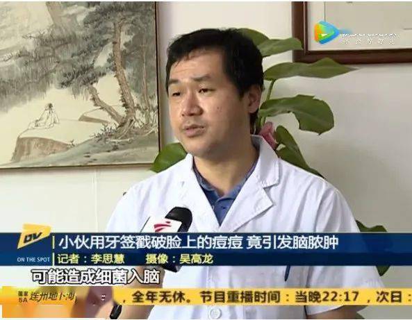 颜值再高也怕它,10倍放大毛孔,黑头清晰可见,这个可视化吸黑头仪太厉害了吧! 颜值再高也怕它,10倍放大毛孔,黑头清晰可见,这个可视化吸黑头仪太厉害了吧!