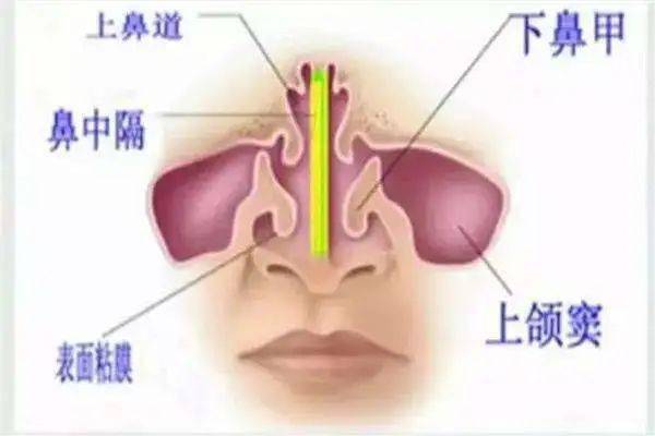 鼻炎引起头昏怎么办