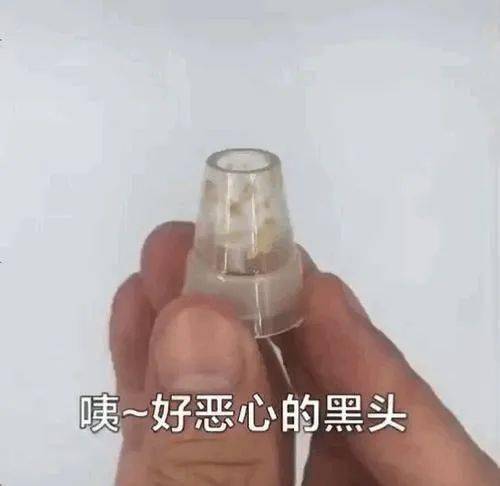 颜值再高也怕它,10倍放大毛孔,黑头清晰可见,这个可视化吸黑头仪太厉害了吧! 颜值再高也怕它,10倍放大毛孔,黑头清晰可见,这个可视化吸黑头仪太厉害了吧!