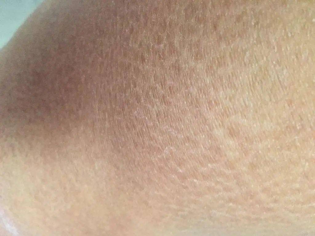 皮肤|想知道如何让肌肤常驻18岁吗？想知道明星三四十岁依然拥有靓丽肌肤吗？点进来我告诉你