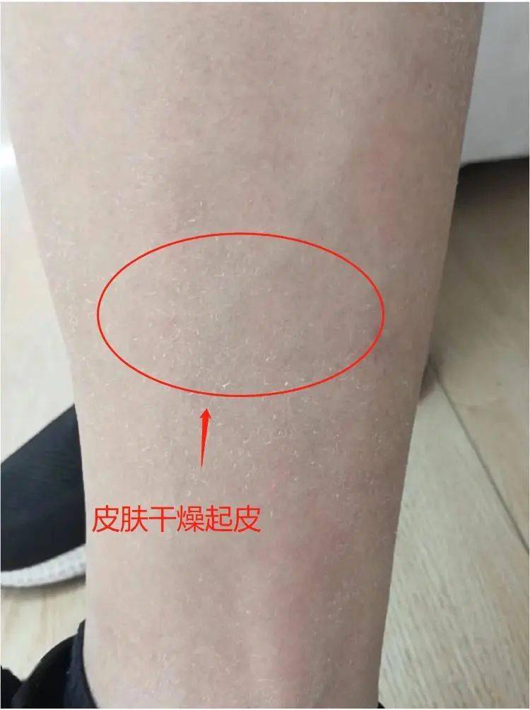 角质|薇娅吹爆的这款磨砂膏,我替你们试了,用完蚊子能在背上劈叉!