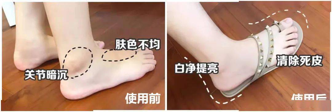 肌肤|30年老国货，别因便宜而嫌弃，一瓶用全身，真正实力派