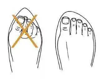 凶手|【警惕】男子险被截肢，凶手竟是一条鱼！只因忽视了这个细节...