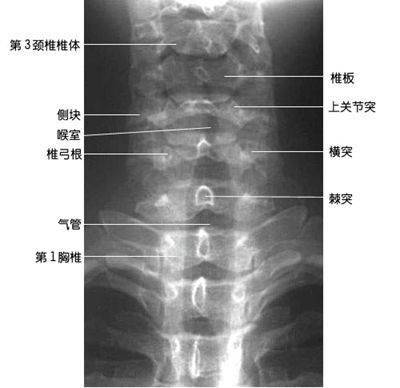 最全总结脊柱的x线解剖太赞了