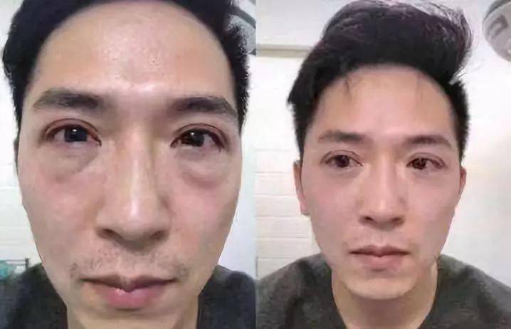 方法|眼袋显老又显丑，教你一方法轻松干掉它！！