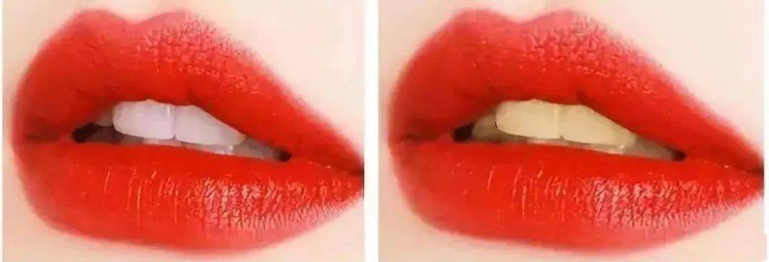 牙膏|牙黄真的太毁颜值！连涂口红都没人家好看