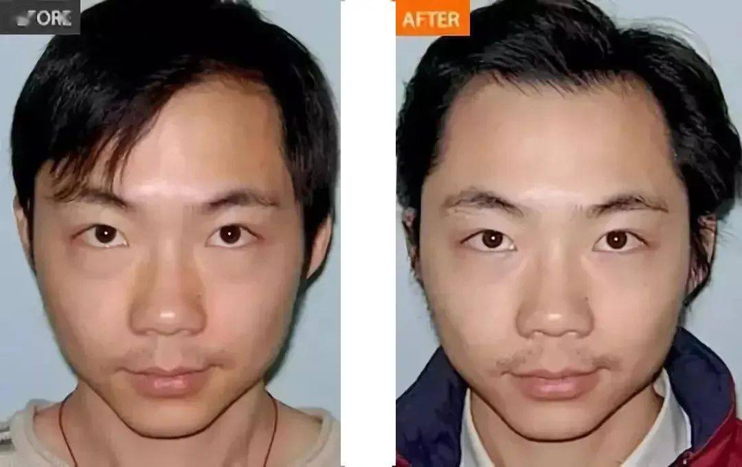 方法|眼袋显老又显丑，教你一方法轻松干掉它！！