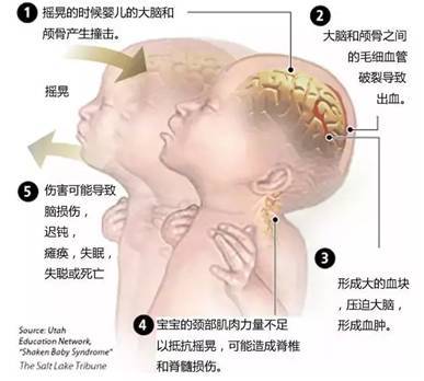 家长|宝宝嗜睡精神差竟因家长这个动作！这个错误你一定犯过......