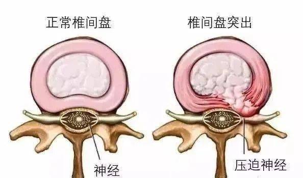 健康| 超长梅雨季已过,ta的表现还突出吗?