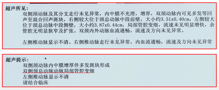 患者|cTNI最高达1.78ng/mL,一定是急性心梗吗?