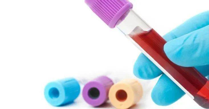 抗体|干燥综合征，这7项体检指标千万别误解！