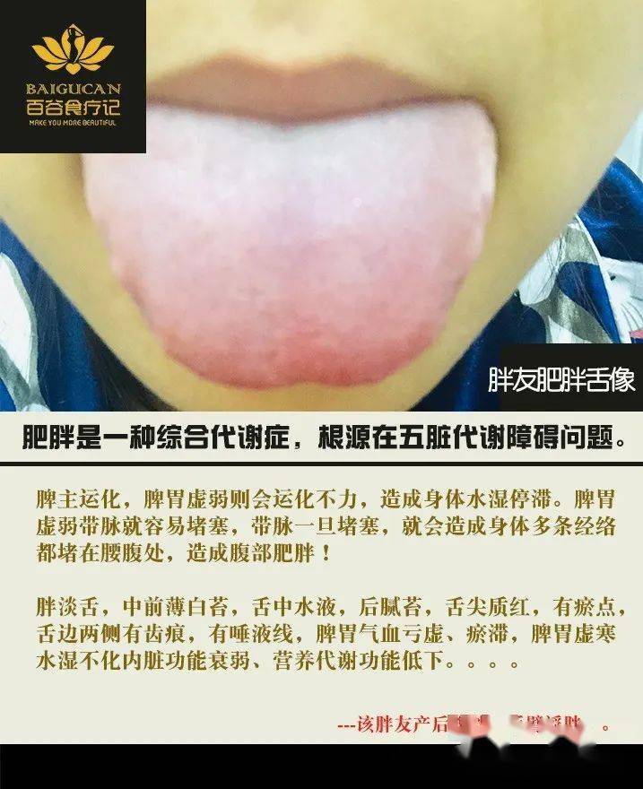 【肥胖舌诊3~胖只是表面,成功减肥要找到肥胖的内在根源