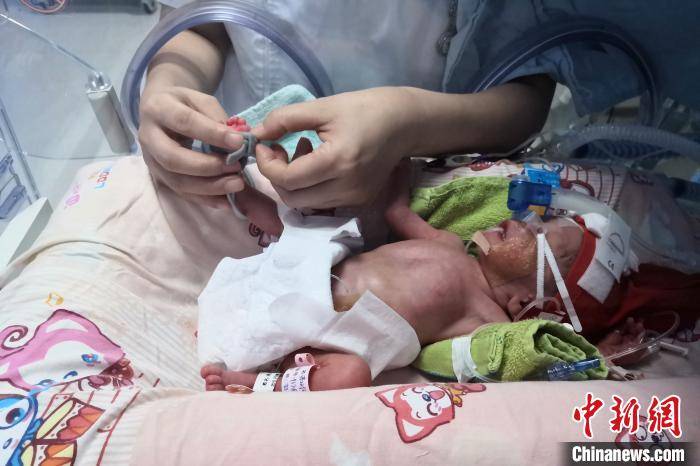 自然|湖北宜昌产妇诞下罕见龙凤四胞胎