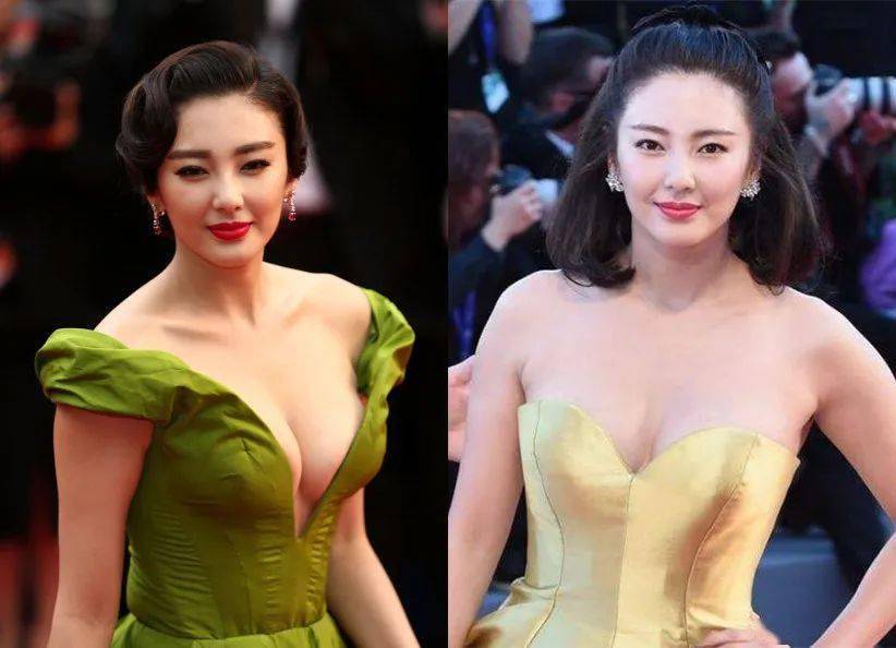 小飒|张雨绮都逆天改变“天然壮”了，这些瘦腿大法你还不快学起来？