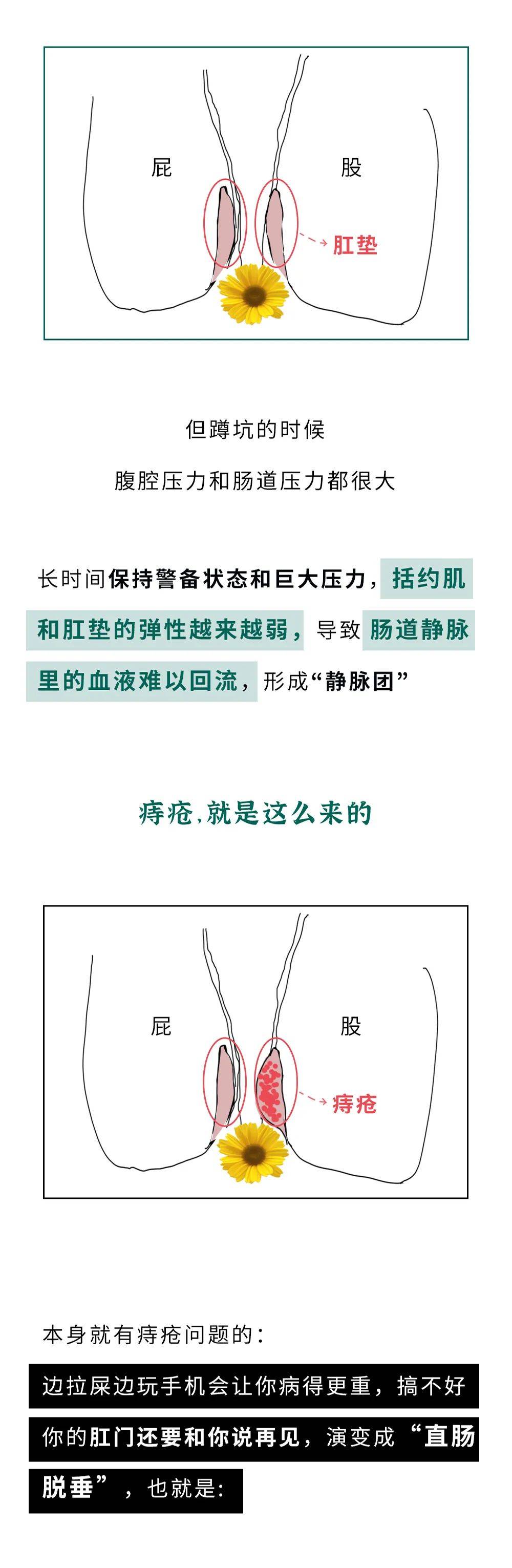 拉屎玩手机，危害居然这么大？（组图）