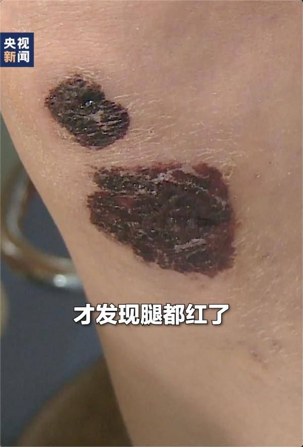 孙金花|她拖着伤腿，跪地救人近20分钟……