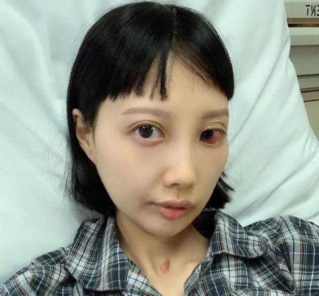 加油！30岁香港歌手抗癌8年，癌细胞已扩散全身