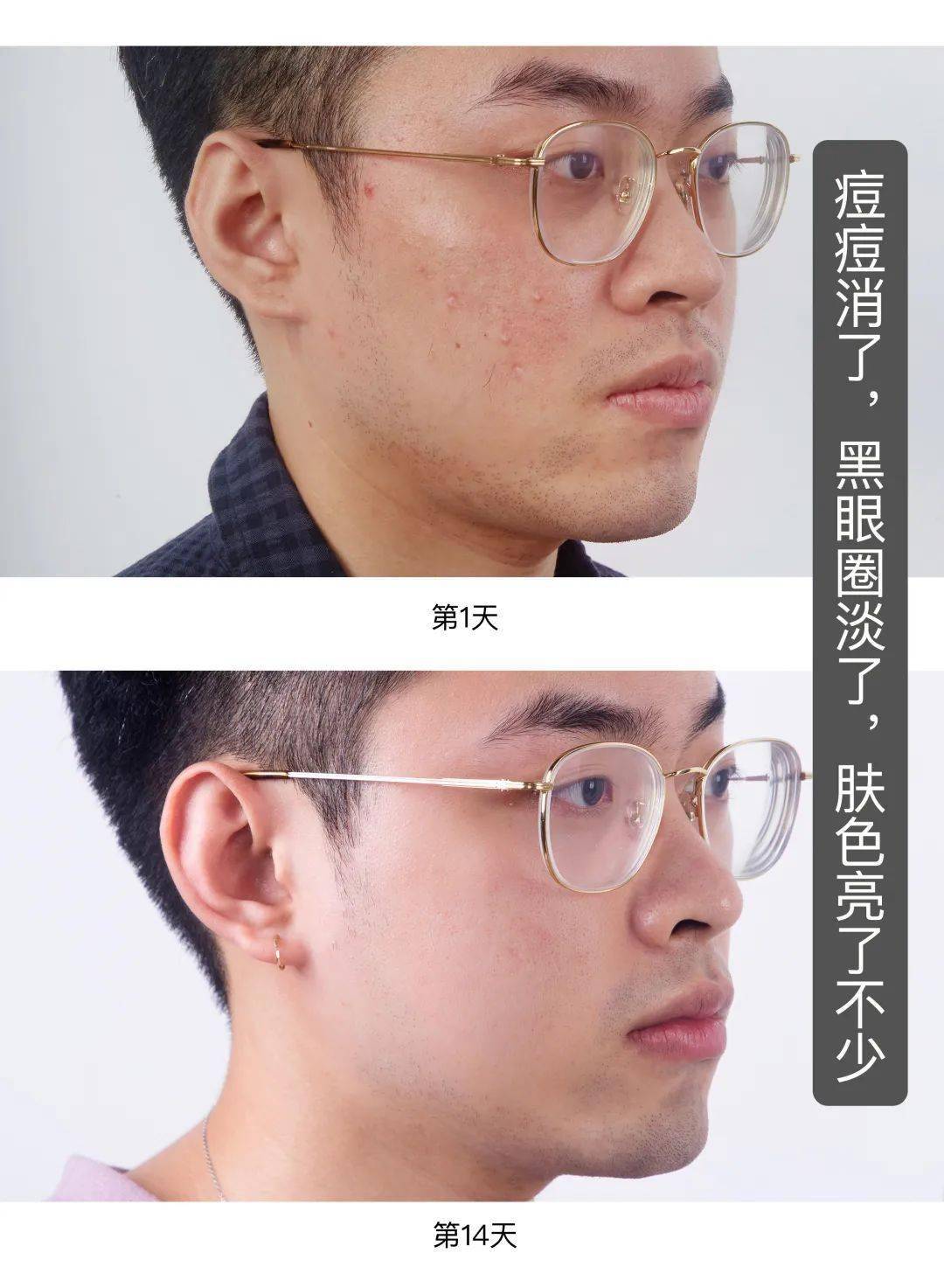 腰子|明星亲测推荐！红腰子平替精华液，30岁的人生自己定义！