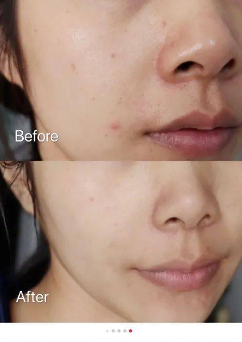 肌肤|40岁的年龄，18岁的脸，深扒“金喜善们”的冻龄术，竟然都是它！