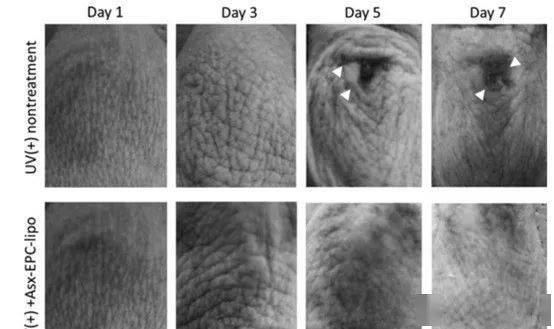 肌肤|40岁的年龄，18岁的脸，深扒“金喜善们”的冻龄术，竟然都是它！