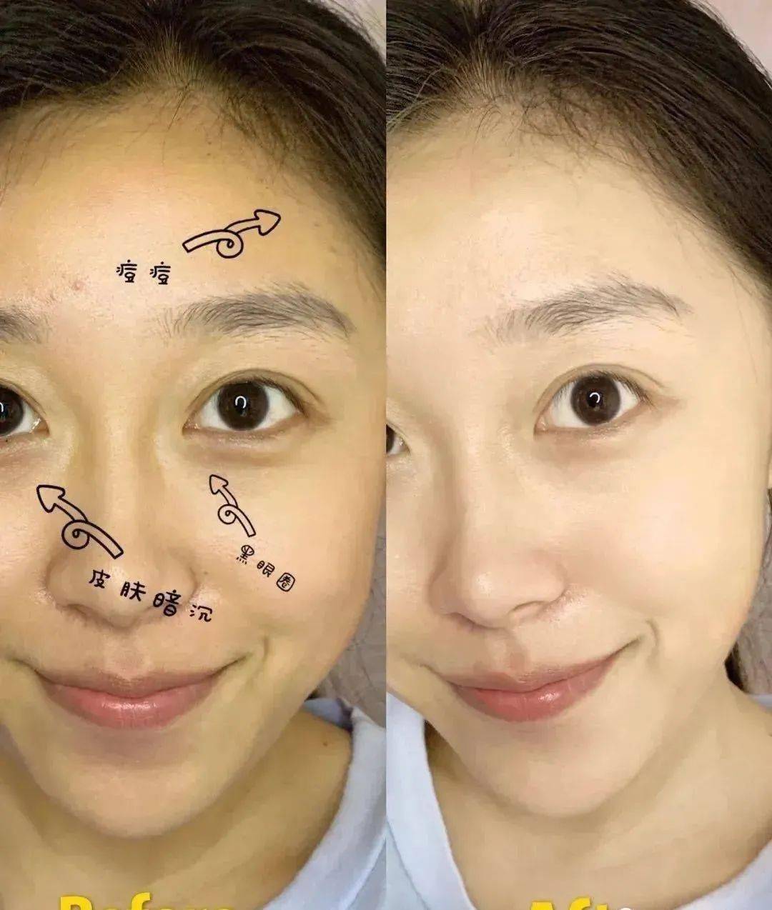 肌肤|40岁的年龄，18岁的脸，深扒“金喜善们”的冻龄术，竟然都是它！