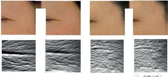 肌肤|40岁的年龄，18岁的脸，深扒“金喜善们”的冻龄术，竟然都是它！