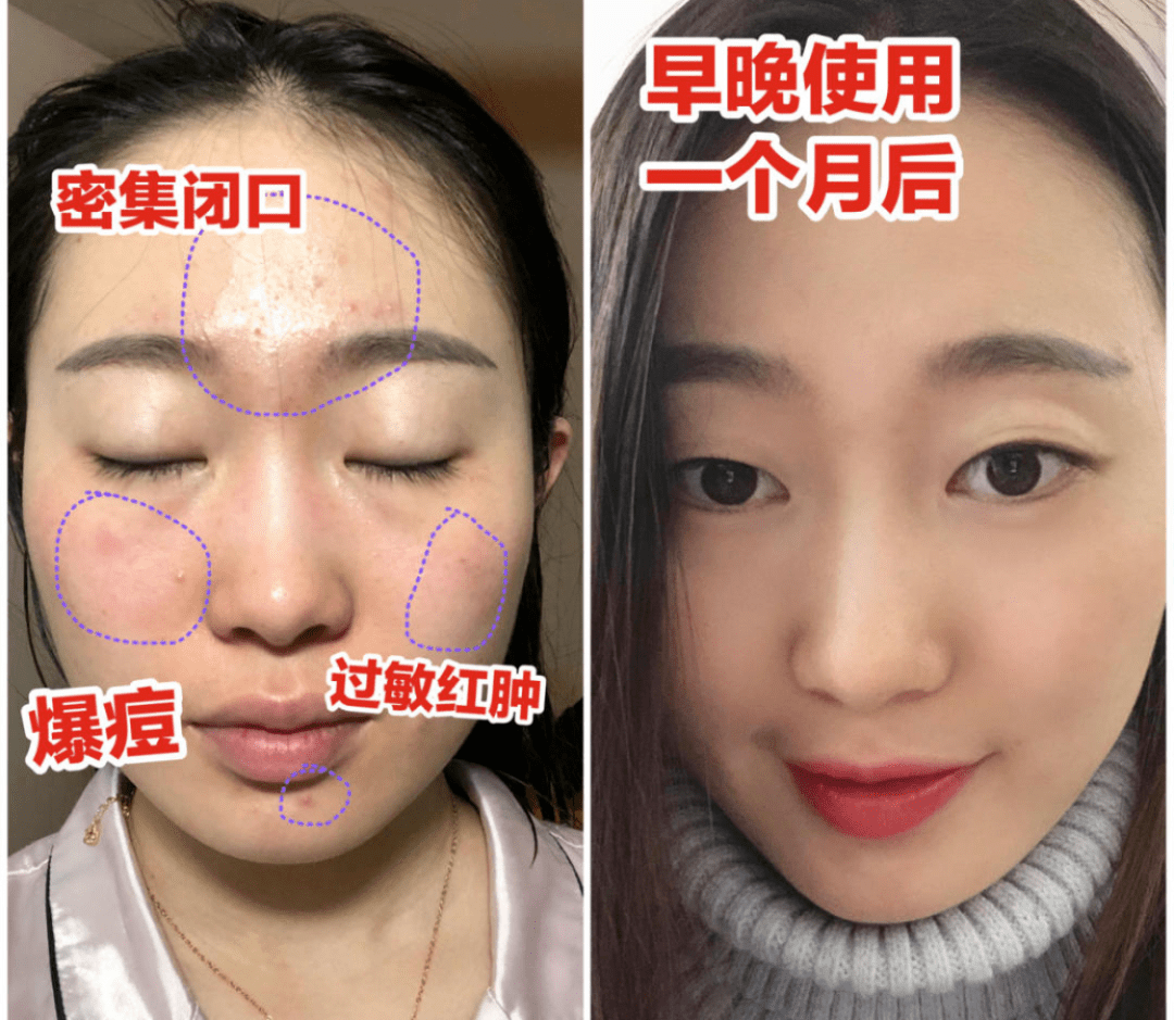 正品|99元抢正品海蓝之谜！直接省上千元，还等什么赶紧囤啊！