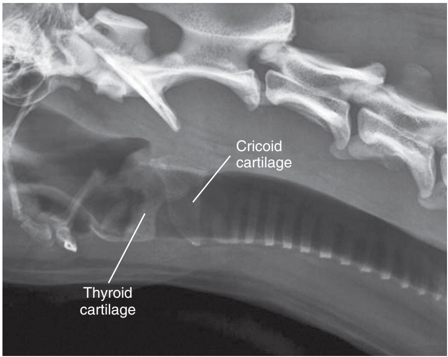 咽部、喉部和气管的放射学解剖结构与读片技巧_软组织