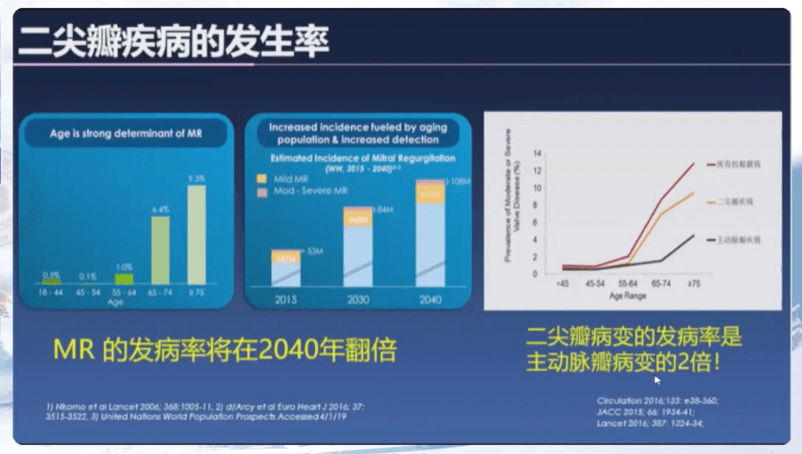 华教授|CCCP 2020｜周胜华教授：二尖瓣治疗术的未来新发展