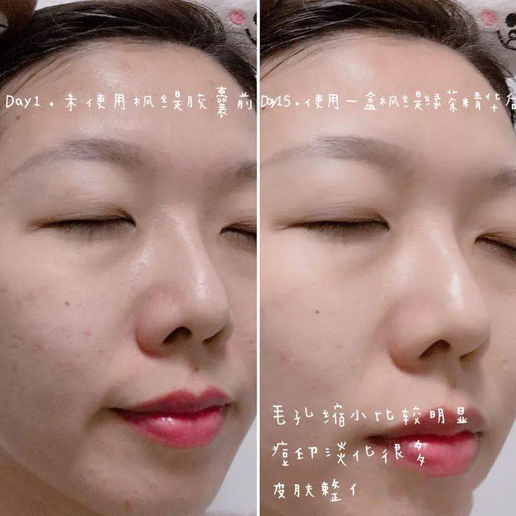 脸蛋|你的脸蛋“一键美颜”,除了滤镜还靠什么?