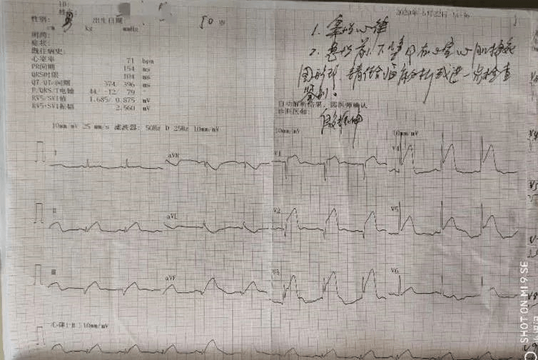 马先生|胃痛2天就诊消化科，一查竟然是心梗了！