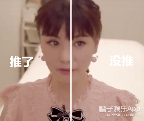 差异|虽然承认整容了，但这前后差异也太大了…