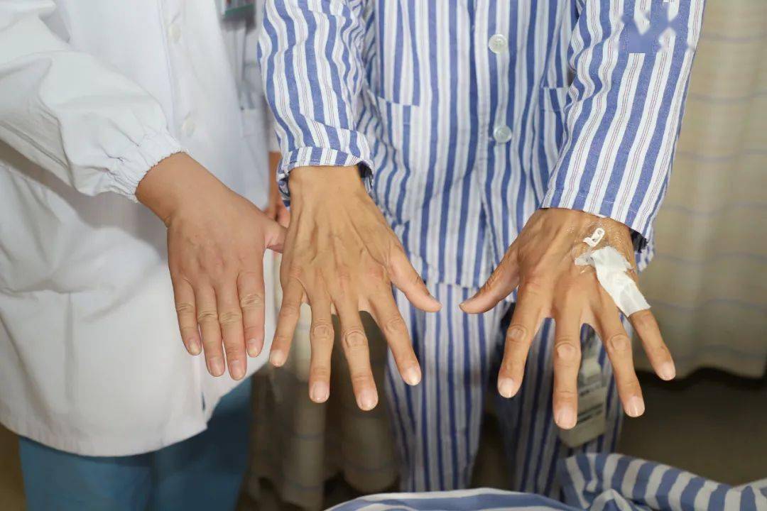 患者|一家三人都是高个子、大长腿，竟然是这种可怕的遗传病！