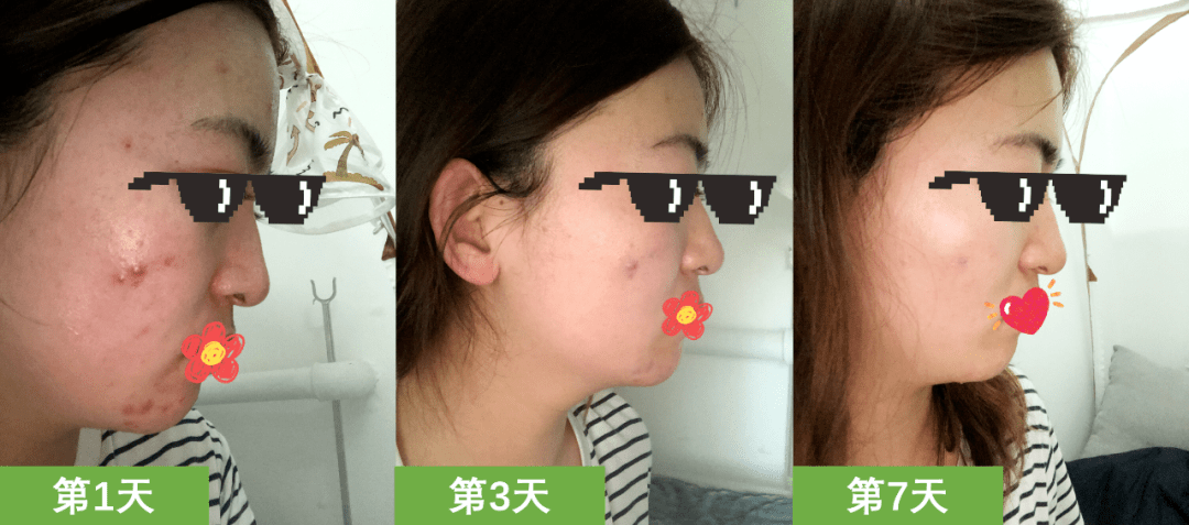 保养|张雨绮每月保养脸疑花70万，听了伊能静的金额……贫穷限制了我的想象