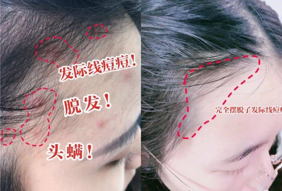 发丝|?日式神级干发帽, 5分钟告别头发湿哒哒!不伤发丝、不掉毛 ,人手必备!