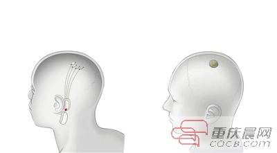马斯克|马斯克遇上 三只小猪 人类脑机接口 要成真了?