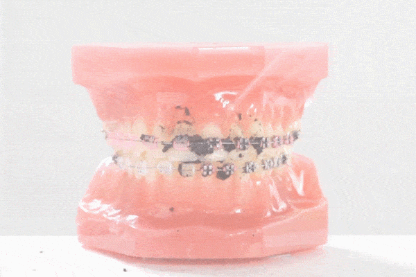 食物残渣|到底有多重要？你有一口好牙