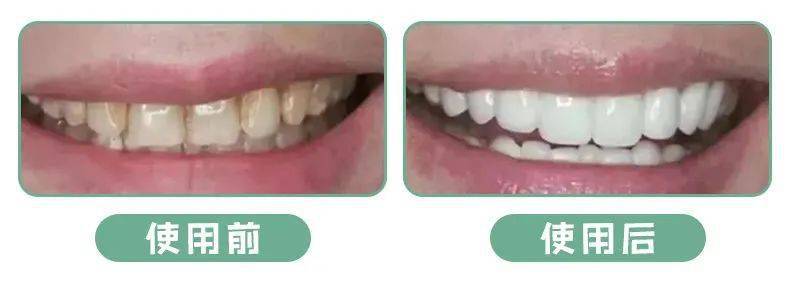 好闻|可以嚼的“漱口水”！好看好嚼好闻，口吐清新…