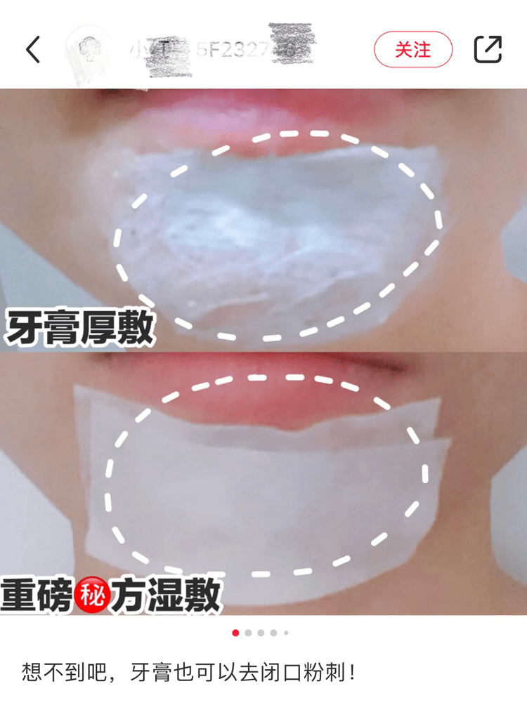 皮筋|小红书，求求你别再骗人了！