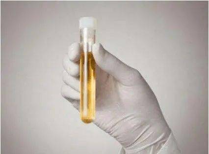 尿液|箭头高高低低看不懂？不懵圈、不求人，一篇教你看懂尿常规！