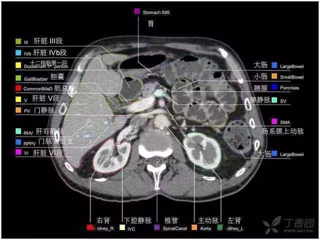 掌握这篇解剖,晋级腹部ct影像诊断高手!_图谱