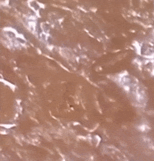 痘痘|背上长痘？神奇“液体”硫磺皂，60秒揪出万千螨虫，李佳琦卖了3万瓶！