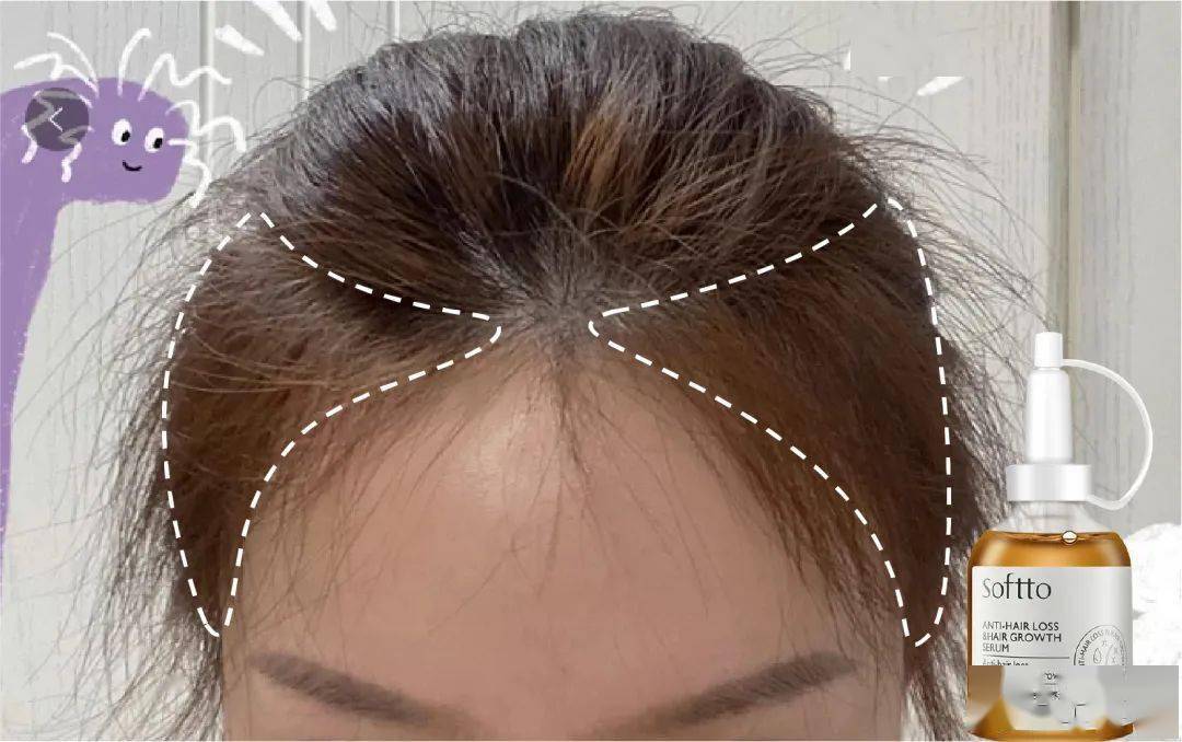 滋养液|32年才做成的育发液!让你挑战30天+生出小绒毛