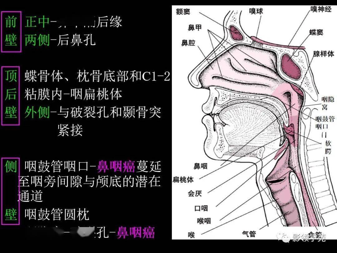 鼻咽部ct解剖