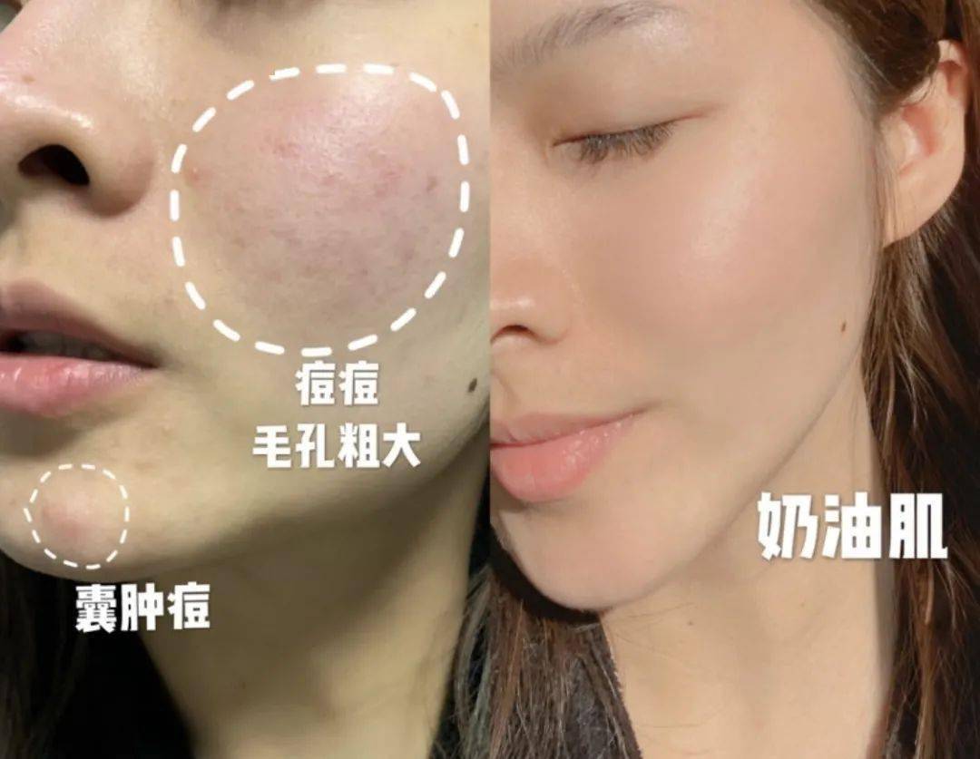 肌肤|还在敷“过气面膜”？！这款不到40元的爆款面膜让你换季肌肤都能水水润润！