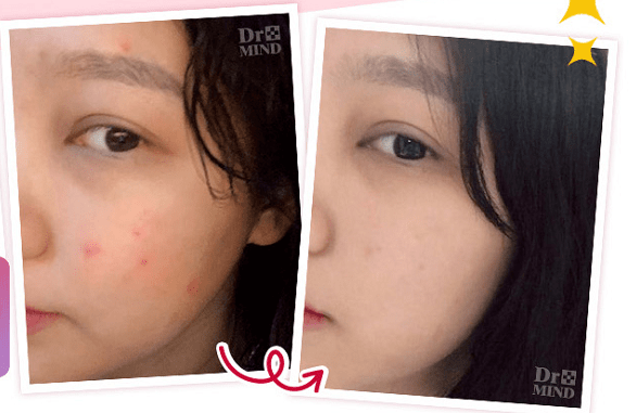 肌肤|还在敷“过气面膜”？！这款不到40元的爆款面膜让你换季肌肤都能水水润润！