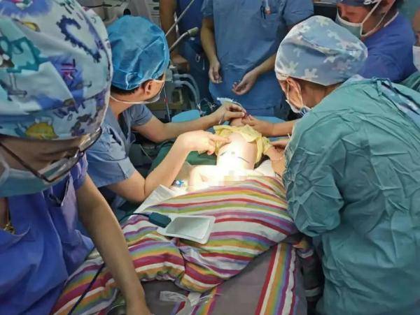 寄生|竟还有一个胎儿！四肢完整…江西刚满月的男婴体内